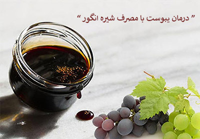 درمان یبوست با مصرف شیره انگور