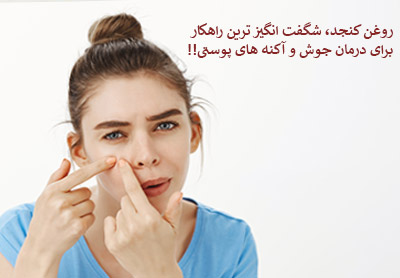 روغن کنجد شگفت انگیز ترین راهکار برای درمان جوش و آکنه های پوستی!!